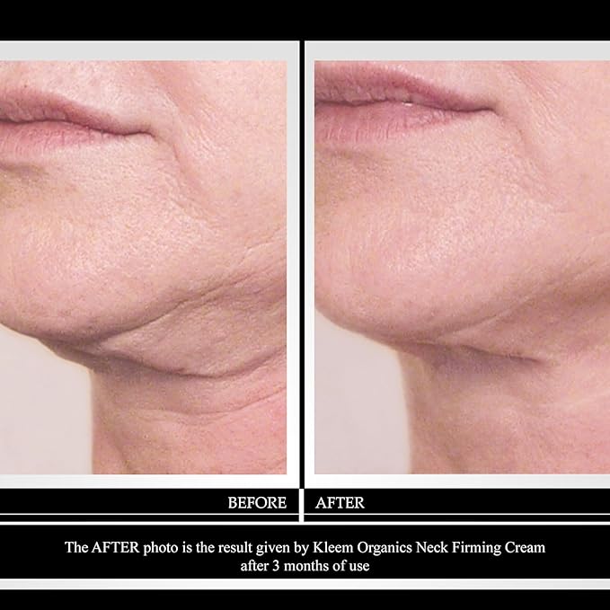 Neck Firming Cream with Peptides & Retinol - Anti Aging Skin Tightening Cream to Reduce Wrinkles, Neck Lines, Age Spots & Sagging Skin - Natural Firming Neck Cream for Smooth & Youthful Skin - 1.7 oz
