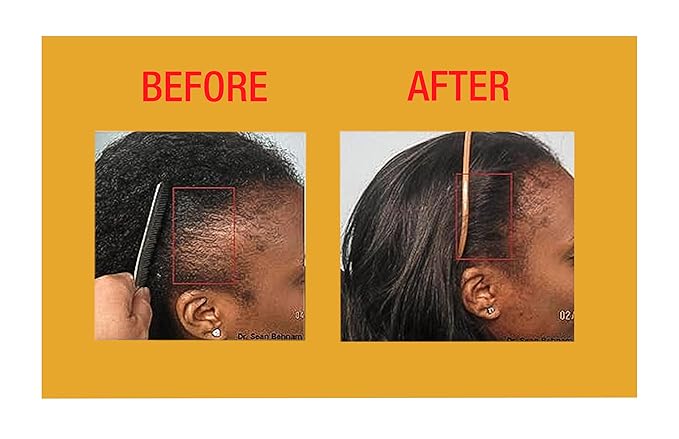 GOOD2GRO Edge Control Gel - 4oz | Instant Hold, Moisture Infusion & Shine Boost | Repair & Restore Thicker Edges Growth | Vegan & Cruelty-Free