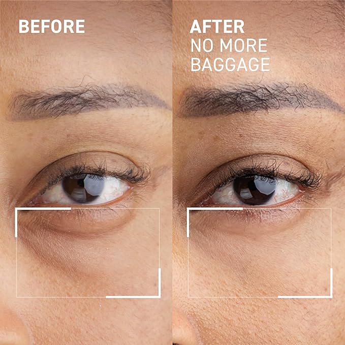 Dr. Brandt Needles No More, No More Baggage - 1 oz (Jumbo Size) - Minimizes Under-Eye Bags, Puffiness & Dark Circles