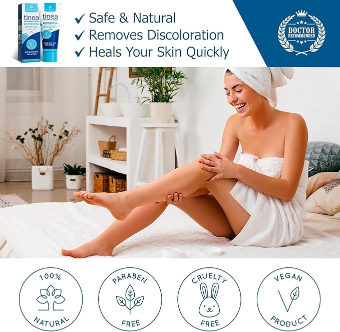 Roycederm Tinea Versicolor Treatment, Athletes Foot Treatment, Ringworm Treatment for Humans, for Tinea Versicolor & Pedis,Fast Healing Anti Fungal Skin Cream - Multi-Functional