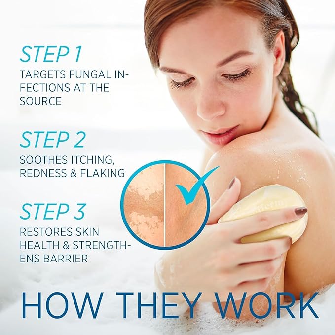 Tinea Versicolor Relief Cream & Soap Kit - Helps with Tinea Versicolor, Fungal Skin Conditions – Soothes, Cleanses, and Restores Skin Health