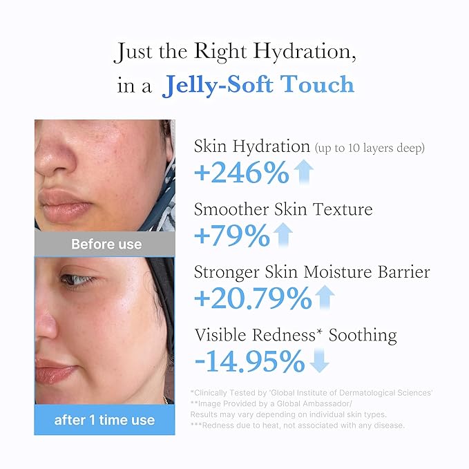 medicube Hyaluronic Acid Moisturizing Jelly Cream | Daily Moisturizer for All Skin Types | Long-lasting Hydration with Hyaluronic Acid, Ceramides, Multi Peptides | Supports Skin's Natural Barrier