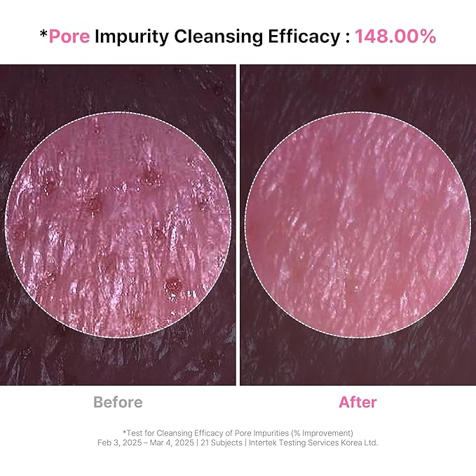 4-in-1 Konjac Jelly Face Cleanser – Gentle Daily Exfoliating, Deep Cleansing, Pore Care & Makeup Removal | Berry Smoothie Texture with Raspberry & Vitamin B+C+E Complex | Dermatologist-Tested