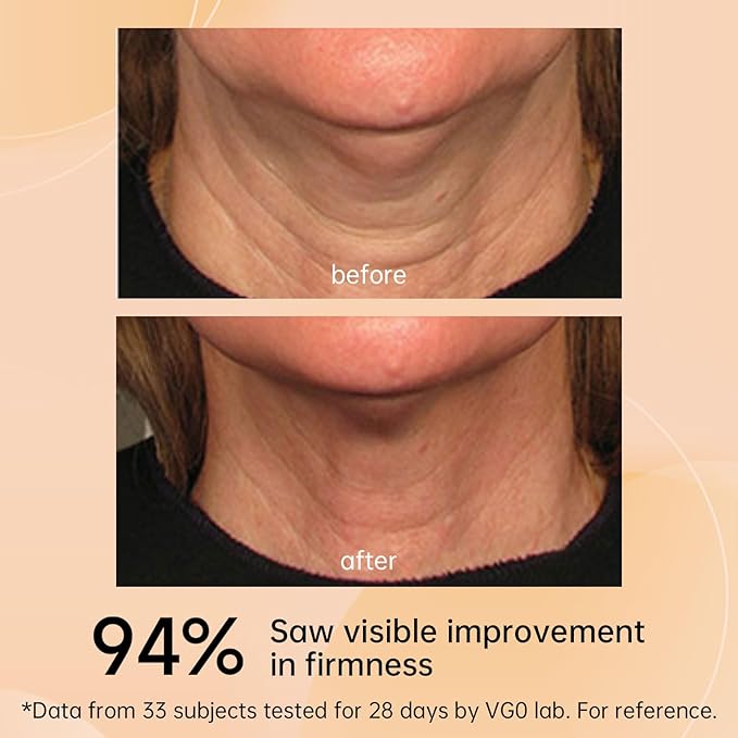VGO Neck Creams for Tightening and Firming, Face Cream for Anti Aging Moisturizer, Hyaluronic Acid and Retinol Enriched for Neck and Face to Target Fine Lines sagging & Dryness. 4.23 Fl Oz