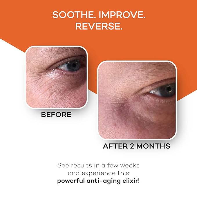 Zocufill Elixir Eye Gel and Face Serum – Helps Reduce the Appearance of Dark Circles, Puffiness, Fine Lines & Wrinkles