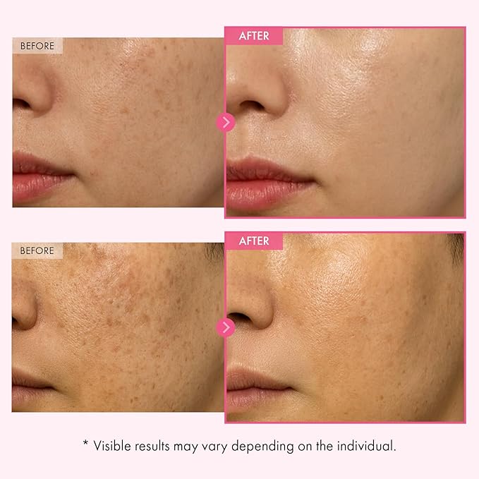 TOSOWOONG Arbutin 7% Glutathione Cream, 70,000ppm Arbutin + 5,001ppm Glutathione, Niacinamide, Dark Spots, Freckle, Blemishes, Pigmentation, Dullness, Uneven Tone, Korean Skin Care, 50ml, 1.69 fl.oz.