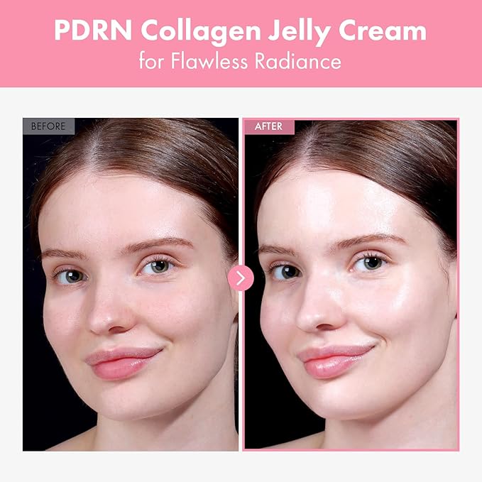 PDRN Hyaluron Face Cream, 5,000ppm Salmon DNA, Niacinamide, Hyaluronic Acid and Panthenol Moisturizer for Hydrating & Firming, Uneven Skin Tone Care, Korean Skincare, 50ml / 1.69 fl. oz.