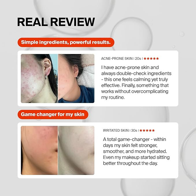 Pixcell Biom 2B/mL Probiotic Essence - Restores Skin Barrier with Bifida, Lactobacillus Ferment Lysate, Korean Probiotic Drops for acne prone skin and sensitive skin (55ml, 1.85 Fl Oz.)