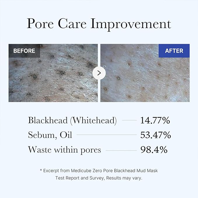 Medicube Zero Pore Blackhead Mud Facial Mask - Skin Cooling & Pore Tightening - 3 Minute Quick Dry Formula with AHA, BHA, PHA, and Pore-Purifying Clay - Korean Mud Mask 3.52 oz