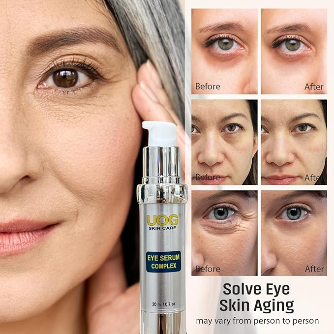 UOG (United One) Eye Serum Complex – Rapid Reduction Eye Serum for Dark Circles, Puffiness, Wrinkles & Crow’s Feet | Anti-Aging Formula for Firm, Youthful Eyes | Hydrates & Smooths (20ml / 0.7oz)