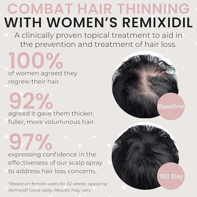 2% Minoxidil for Women Hair Regrowth Spray– Minoxidil Thicker & Fuller Topical Solution for Hair Loss Treatment, Follicle Reactivation - 60 ml (Pack of 2)