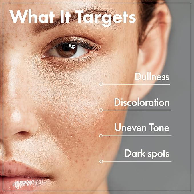 TOSOWOONG Arbutin 7% Glutathione Cream, 70,000ppm Arbutin + 5,001ppm Glutathione, Niacinamide, Dark Spots, Freckle, Blemishes, Pigmentation, Dullness, Uneven Tone, Korean Skin Care, 50ml, 1.69 fl.oz.