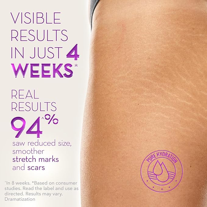 Cicatricure Cica Oil for Stretch Marks & Scars, Visible Results in 4 Weeks, Pregnancy Must-Haves Body Oil with Vitamin E, Stretch Mark Oil, Scar Treatment with Botanical Ingredients, 6.7 fl oz