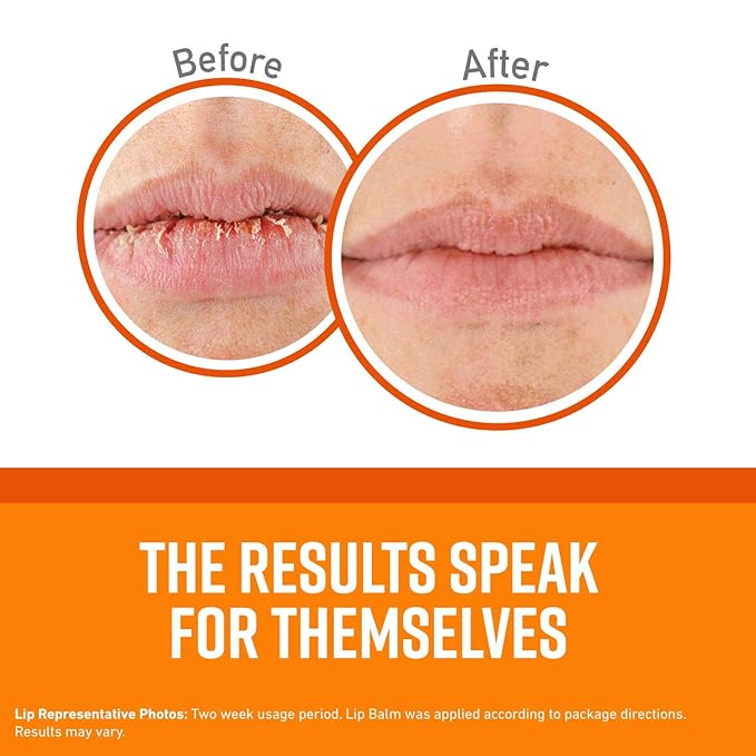 O'Keeffe's Lip Repair Lip Balm Set for Dry, Cracked Lips - Stick (Pack of 3: 1 Cooling + 1 Unscented + 1 SPF) - Moisturizer for for Extremely Cracked, Dry Lips