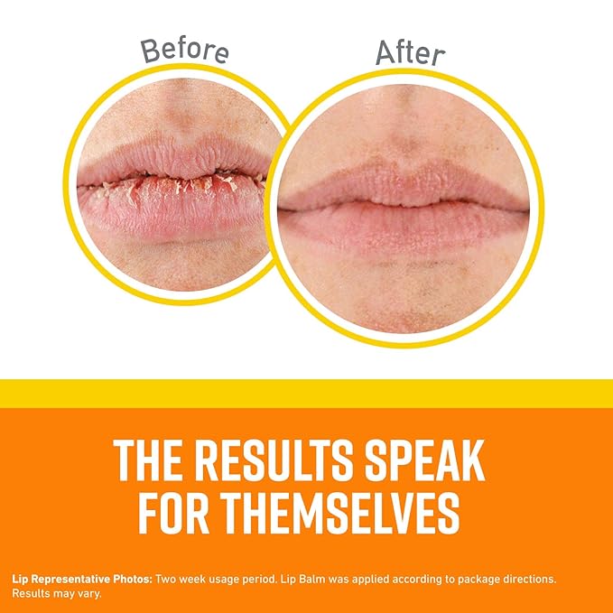 O'Keeffe's Lip Repair SPF 35 Lip Balm - Stick (1 Pack) - Sun-Safe Moisturizer for Extremely Cracked, Dry Lips