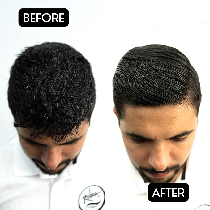 Rolda Power Styling Gel Hair Loss Control 17.6oz