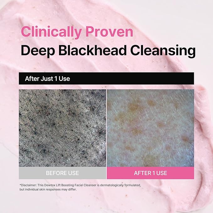 Dewtox Lift Boosting Facial Cleanser, Face Mask, Foaming Cleanser, Skin Enhancement All in One, Face Wash for Sensitive Skin, Korean Skincare (5.07 Fl Oz / 150ml)