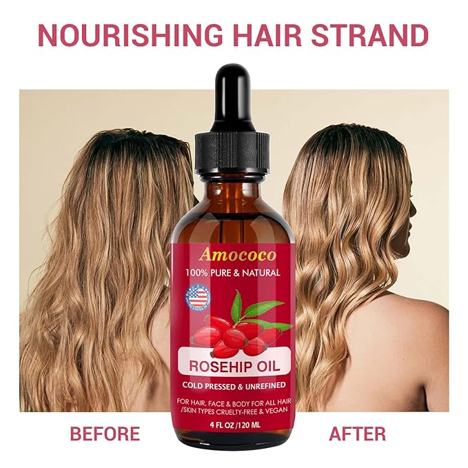 Organic Cold Pressed Rosehip Oil for Face, Natural Rose Hip Seed Oil, Nutrient Rich Facial Serum for Skin Care, Moisturize Dry Skin, 1 Fl Oz (30mL)