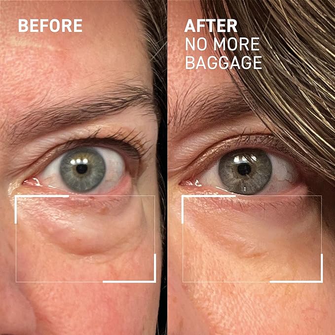 Dr. Brandt Needles No More, No More Baggage - 0.23 oz, Pack of 2 - Minimizes Under-Eye Bags, Puffiness & Dark Circles