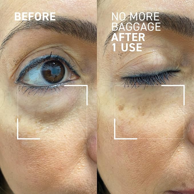 Dr. Brandt Needles No More, No More Baggage - 0.5 oz, Pack of 2 - Minimizes Under-Eye Bags, Puffiness & Dark Circles