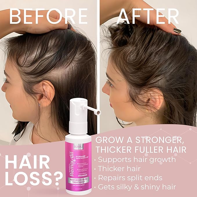 2% Minoxidil for Women Hair Regrowth Spray– Minoxidil Thicker & Fuller Topical Solution for Hair Loss Treatment, Follicle Reactivation, Clinically Proven Formula - 60 ml