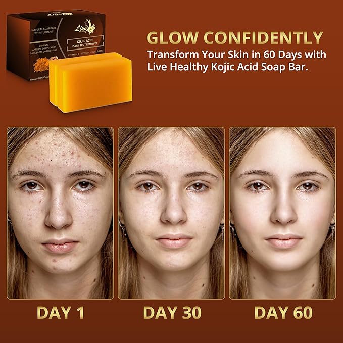Live Healthy Kojic Acid Soap - Skin Brightening and Lightening for a Radiant Complexion - Natural, Gentle, Turmeric Soap Bar for Dark Spots, Uneven Skin Tone & Acne Scars - 2 Pack + Holder & Net