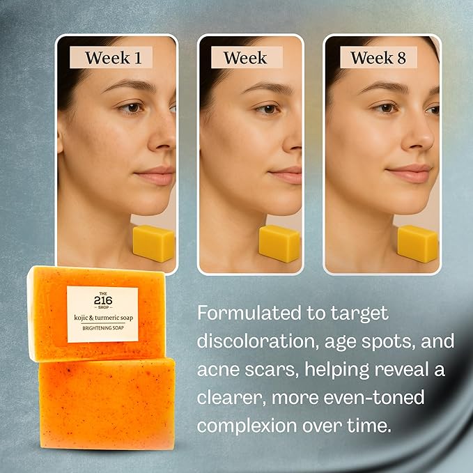 Kojic Acid Dark Spot Remover Soap Bars with Vitamin C, Retinol, Collagen, Turmeric - Original Japanese Complex Infused with Hyaluronic Acid, Vitamin E, Shea Butter, Castile Olive Oil (2 Pack)