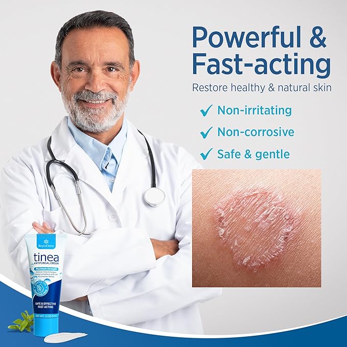 Roycederm Tinea Versicolor Treatment, Athletes Foot Treatment, Ringworm Treatment for Humans, for Tinea Versicolor & Pedis,Fast Healing Anti Fungal Skin Cream - Multi-Functional - Pack of 2