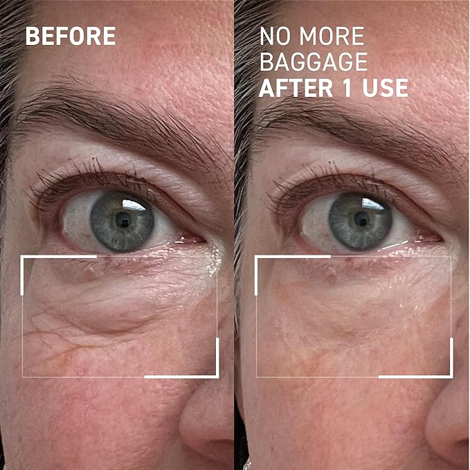 Dr. Brandt Needles No More, No More Baggage - 1 oz (Jumbo Size) - Minimizes Under-Eye Bags, Puffiness & Dark Circles