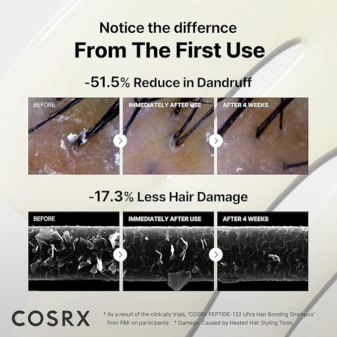 COSRX PEPTIDE 132 Hair Bonding Shampoo - Daily Scalp Treatment for Dandruff, Dry, Itchy or Flaky Scalp - Repairs & Strengthens Damaged Hair, For All Hair Types – 6.76 fl oz