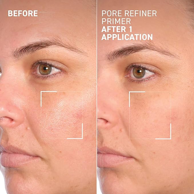 Dr. Brandt Pores No More, Pore Refiner Primer - Instantly Minimizes the Appearance of Pores, Absorbs Oil & Mattifies Shine - 1.0 fl oz