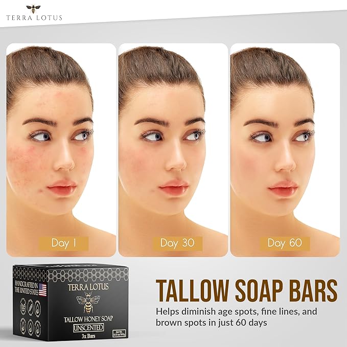Organic Tallow Soap with Organic Castor Oil & Raw Honey - Relief for Dark Spots, Acne Marks, Hydrating & Nourishing - 3 Pack (Citrus)