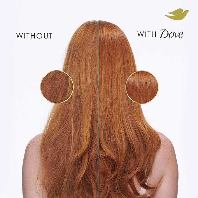 Dove Conditioner Intensive Repair for Damaged Hair with Bio-Protein Care Technology and Amino Serum 28 Fl Oz