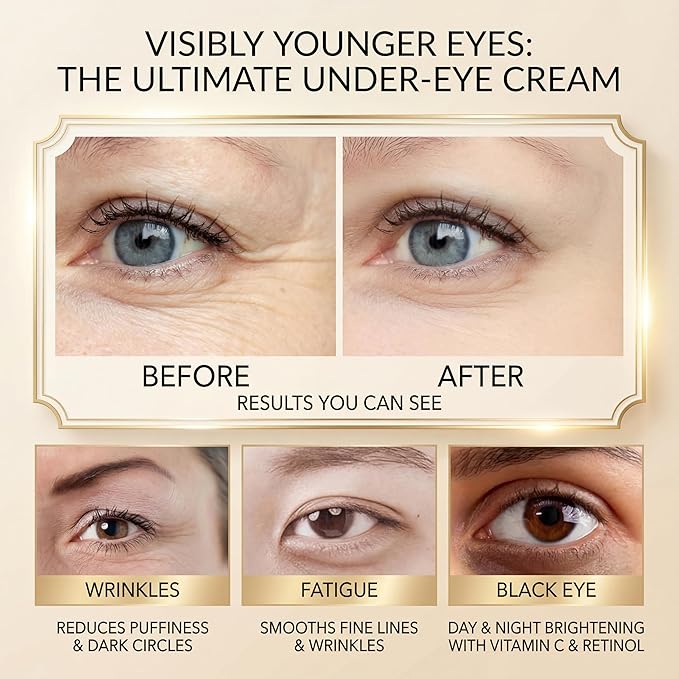 Under Eye Cream Dark Circles, Under Eye Skin Treatment Cream Reduces Puffiness, Fine Lines, Wrinkles and Eye Bags, Day & Night Brightening, Moisturizing & Firming Eye Serum with Vitamin C & Retinol