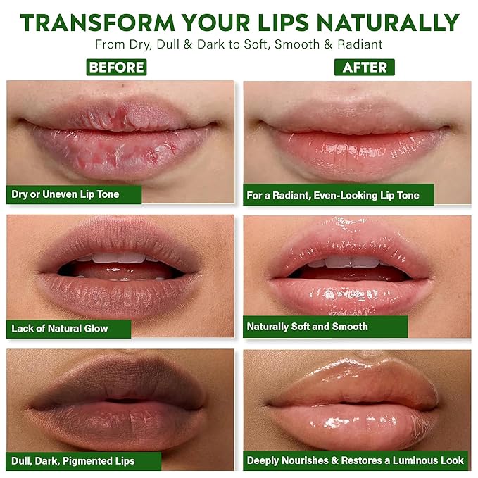 Vegan Ayurvedic Lightening & Brightening Lip Balm for Dark Smokers' Lips | Hydrating & Moisturizing for Dry, Chapped Lips – Plant-Based, Antioxidant-Rich