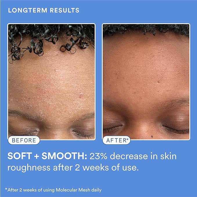 Experiment Molecular Mesh Barrier Repair Face Moisturizer - Soothing Lightweight Face Cream for Strength, Redness, & Irritation - Ectoin, Phytosphingosine, Centella 2 FL OZ - Vegan for Sensitive Skin