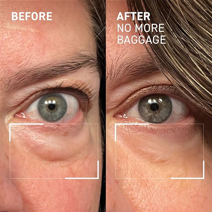 Dr. Brandt Needles No More, No More Baggage - 1 oz (Jumbo Size) - Minimizes Under-Eye Bags, Puffiness & Dark Circles