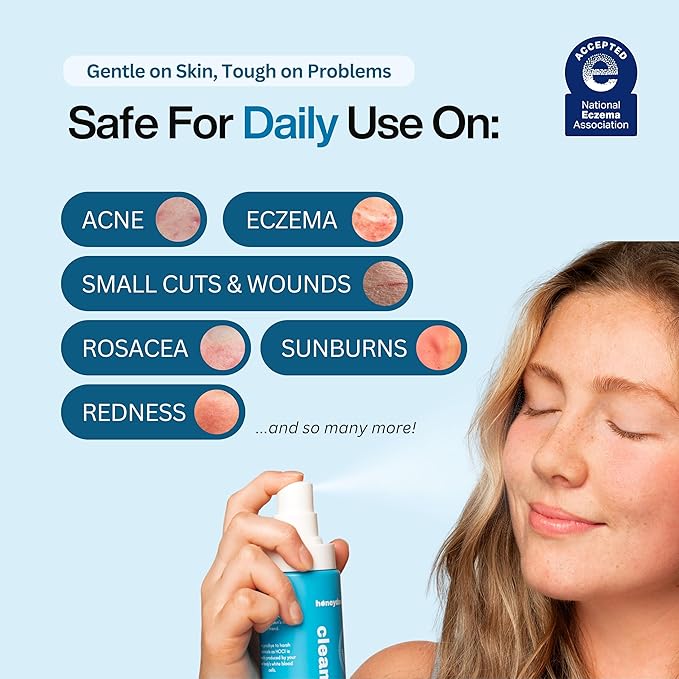 Hypochlorous Acid Spray – Dermatologist Tested HOCl Facial Cleanser for Sensitive, Acne-Prone & Irritated Skin – Soothes Redness, Eczema, Rashes & Itching – Skin Repair Spray, 2 fl oz - Honeydew Labs