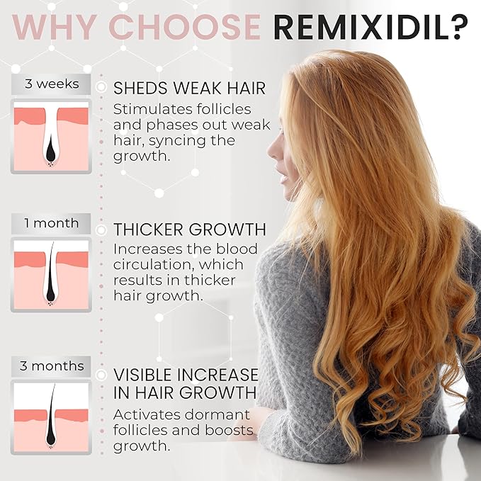 2% Minoxidil for Women Hair Regrowth Spray– Minoxidil Thicker & Fuller Topical Solution for Hair Loss Treatment, Follicle Reactivation, Clinically Proven Formula - 60 ml
